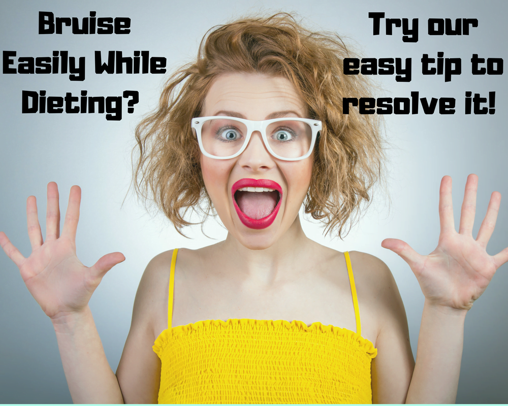 Bruise Easily?  Dieting may increase your risk for bruises unless you try this tip…